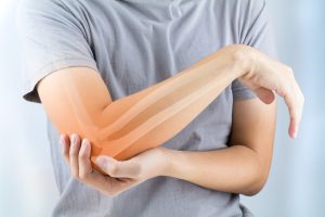 Osteoporose atinge cerca de 10 milhões de brasileiros